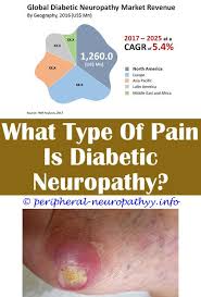 Pin On Peripheral Neuropathy Causes