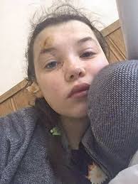 Ukrainian girl rescued from Russian-held hospital by grandfather