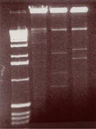 Introduction deoxyribonucleic acid (dna) is a double helix structure strand which contain hereditary genetic material of living organisms. Dna Extraction