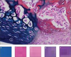 Some, mostly older, compact bone is remodelled to form these haversian systems (or osteons).the osteocytes sit in their lacunae in concentric rings around a central haversian canal (which runs longitudinally).the osteocytes are arranged in concentric rings of bone matrix called lamellae (little plates), and their processes run in interconnecting canaliculi. Analysis Of New Bone Cartilage And Fibrosis Tissue In Healing Murine Allografts Using Whole Slide Imaging And A New Automated Histomorphometric Algorithm Bone Research
