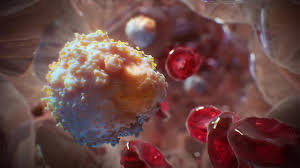 They don't form solid tumours. Development And Spread Of Cancer Cancer Msd Manual Consumer Version