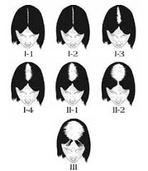 There are lots of unanswered questions about hair loss. Expat Hair Loss And Treatments Oh My Expat Life