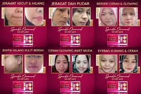 Skin whitening and glutathione without aura. Aurawhite Sparkle Diamond Skincare Aurawhite Beauty