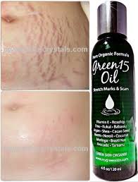 Bio Oil Before After Pin By Bio Oil Before And After On Beautyskin Care In 2020 Body Skin Care Skin Care Beauty Care