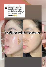 Tina Royal Cosmetic Review