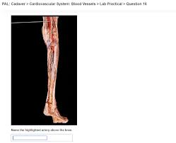 Solved Pal Cadaver Cardiovascular System Blood Vessels Chegg Com