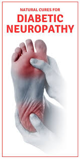 Natural Cures For Diabetic Neuropathy Diabetic Neuropathy Diabetic Health Neuropathy
