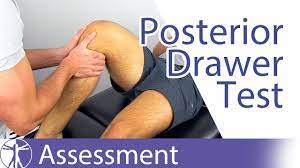 Anterior and posterior draw test animation. Posterior Drawer Test Posterior Cruciate Ligament Youtube