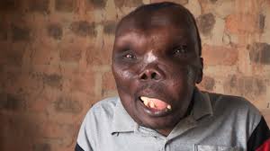 Godfrey was a shoemaker, a profession that barely made ends meet. Uganda S Ugliest Man With An Alien Head Hopes To Use His New Found Fame To Launch A Music Career