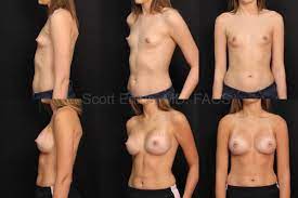 L. SCOTT ENNIS MD, FACS Plastic Surgeon
