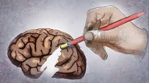 We did not find results for: Krankheiten Alzheimer Krankheiten Gesellschaft Planet Wissen