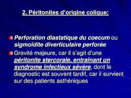 Dlr abdo sévère ou péritonite. Ppt Peritonites Powerpoint Presentation Free Download Id 909397