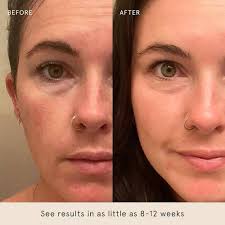 Amazon.com: Barefaced Overachiever