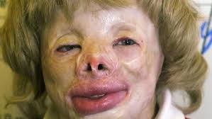 Terri Calvesbert's dream wedding postponed to 2021 because of coronavirus