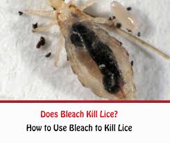 Meanwhile, it has not been medically confirmed, so you should try the recommended treatment for lice that we have discussed earlier. Does Bleach Kill Lice Getridofallthings Com