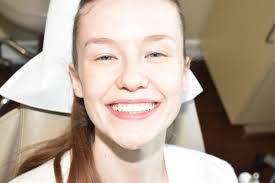 Can Porcelain Veneers Make Me Love My Smile?