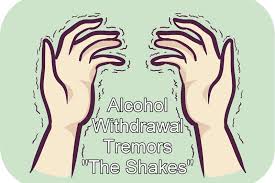 Image result for Alcohol Withdrawal
