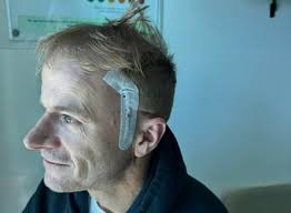 Richard Scolyer says 'prognosis is poor' after brain cancer returns and  surgery unsuccessful