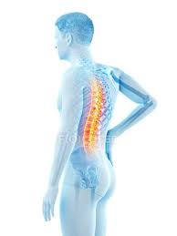 You drive a car with your carpals). Side View Of Male Body With Back Pain On White Background Conceptual Illustration Bones Painful Stock Photo 308613250