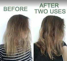 Several treatment cycles are required with the spacing between treatments depends on the body area being treated. 30 Useful Products For Anyone With Damaged Hair