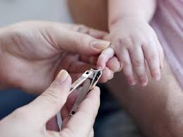 Larangan memotong rambut dan kuku bagi yang hendak berkurban didasari oleh hadits dari ummu salamah hindun bintu abi umayyah maka jelas maksudnya yang dilarang memotong kuku dan rambut adalah orang yang berniat untuk berqurban. Sunah Memotong Kuku Seperti Yang Dilakukan Rasulullah