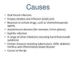 Mouth Ulcers