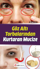 Awesome Beauty Diy Hacks Are Readily Available On Our Internet Site Have A Look And You Wont Be Sorry You Did Beauty Baggy Eyes Eye Bags Under Eye Bags