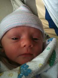 Baby's sudden hair growth