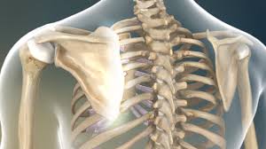 Snapping Scapula Syndrome Orthovirginia