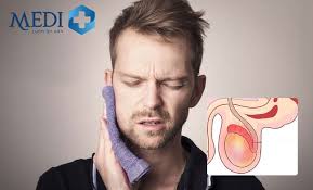 Viêm tinh hoàn nhận biết sớm tránh những tổn thương