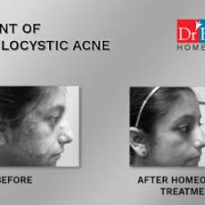You see all dr batra reviews by visiting the site. Dr Batra S Healthcare Dermatologists Book Appointment Online Dermatologists In Thane West Thane Mumbai Justdial
