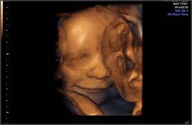 Pregnancy Week 33