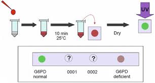 Image result for G6PD Deficiency Detection