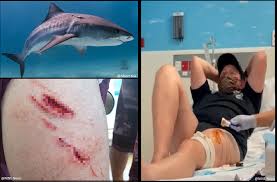 Three recovering from recent shark bites in California, Bimini, and Queensland