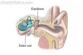 Meniere S Disease Definition Causes Symptoms Complications And Cost Surgery Treatment Hospital In India