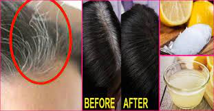 White hair means there is a complete pigment loss. 10 Causes Of White Hair And 12 Ways To Prevent It Naturally