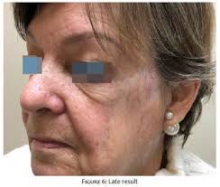 Surgical & Cosmetic Dermatology