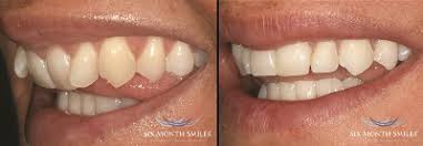 Apply for free education and funding in south africa. Affordable Gentle Dentist Umhlanga