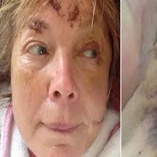 Children's author's terror as she's almost trampled to death by cows while  walking her dogs