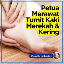Sebenarnya, terdapat banyak punca tumit merekah. Cara Merawat Tumit Kaki Merekah Dan Kering Puan Mary