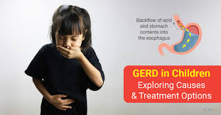 Image result for Pediatric Reflux