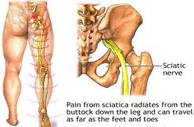 Check spelling or type a new query. Viral Oh Viral Kerap Rasa Sakit Dan Ngilu Di Pinggul Facebook