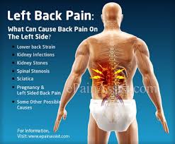 A ruptured abdominal aortic aneurysm can result in sudden pain radiating to the left lower abdomen and back. Pin On Back Pain