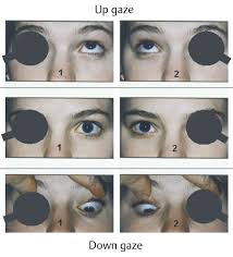 Image result for Cover Test