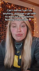 Girl Loses Arm But Not Eyelashes