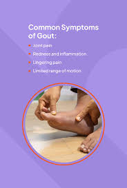 Image result for gout symptoms toe