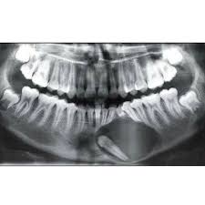 What Do You Think About Think This Case Dental Dental Fun Dental Hygenist