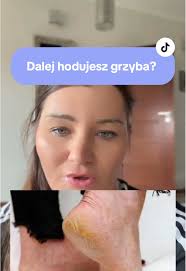 Holistyczne podejście do problemów ze stopami