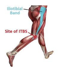 Lateral Knee Pain Diagnosis Treatment Knee Pain Explained
