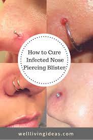 Note that it is quite normal for a properly healing nose piercing to ooze a thin clear fluid; Pin On Essential Oils Natural Remedies